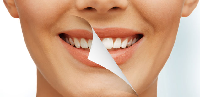 как отбелить зубы